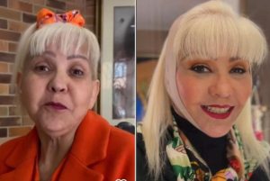 ‘Veo lo que yo quería ver’: la Gorda Fabiola tras su cirugía en el rostro